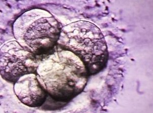 湘潭雨湖区做试管婴儿的医院有哪些？湘潭雨湖区做试管婴儿的医院有哪些呢？